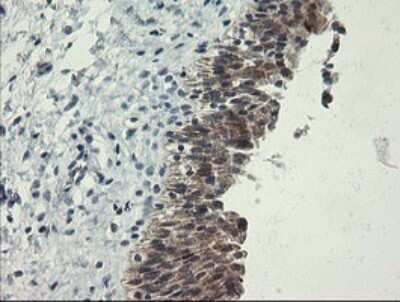 Immunohistochemistry: RPC62 Antibody (OTI2H1) [NBP2-45900] - Analysis of Human bladder tissue.