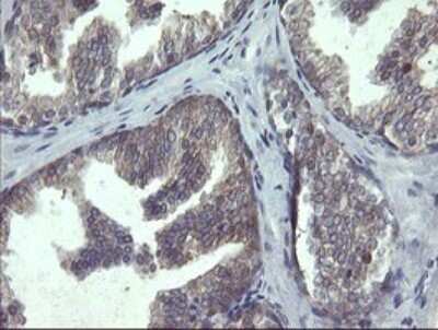 Immunohistochemistry: RPC62 Antibody (OTI2H1) [NBP2-45900] - Analysis of Human prostate tissue.