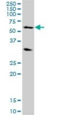 Western Blot: RPC62 Antibody [H00010623-B03P] - Analysis of POLR3C expression in Hela S3 NE.