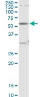 Western Blot: RPC62 Antibody [H00010623-B03P] - Analysis of POLR3C expression in PC-12.