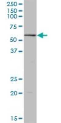 Western Blot: RPC62 Antibody [H00010623-B03P] - Analysis of POLR3C expression in human placenta.