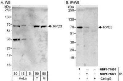 Western Blot: RPC62 Antibody [NBP1-71821] - Whole cell lysate from HeLa (H; 50 mcg for WB; 1 mg for IP, 20% of IP loaded), 293T (5, 15, and 50 mcg for WB) and mouse NIH3T3 (M; 50 mcg) cells.   Affinity purified rabbit anti-RPC3 antibody used for WB at 0.4 mcg/ml (A) and 1 mcg/ml (B) and used for IP at 6 mcg/mg lysate.  RPC3 was also immunoprecipitated by rabbit anti-RPC3 antibody NBP1-71820, which recognizes an upstream epitope.