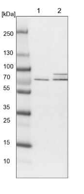 Western Blot: RPC62 Antibody [NBP1-87110] - Lane 1: NIH-3T3 cell lysate (Mouse embryonic fibroblast cells) Lane 2: NBT-II cell lysate (Rat Wistar bladder tumour cells)