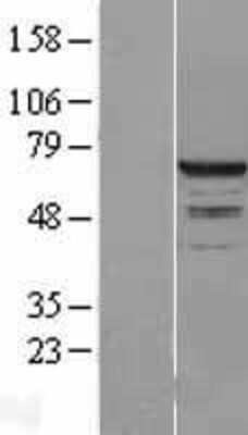 Western Blot: RPC62 Overexpression Lysate (Adult Normal) [NBL1-14591] Left-Empty vector transfected control cell lysate (HEK293 cell lysate); Right -Over-expression Lysate for RPC62.