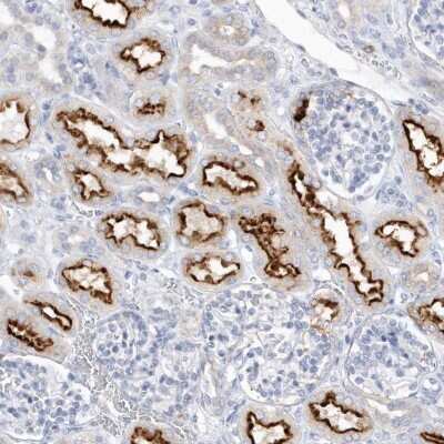 Immunohistochemistry: RPE Antibody [NBP2-32668] - Staining of human kidney shows strong membranous positivity in cells in tubules.