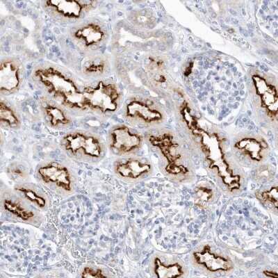 Immunohistochemistry: RPE Antibody [NBP2-32668] - Staining of human kidney shows strong membranous positivity in cells in tubules.