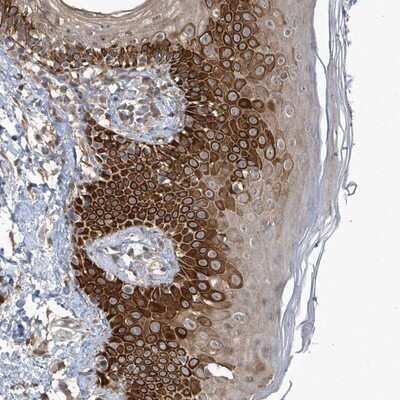 Immunohistochemistry-Paraffin: RPE Antibody [NBP1-86286] - Staining of human skin shows strong cytoplasmic positivity in subsets of epidermal cells.