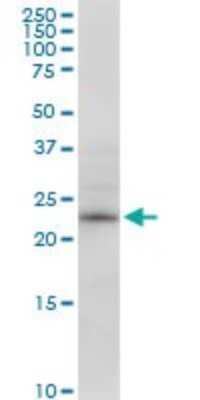 Western Blot: RPE Antibody [H00006120-B02P] - Analysis of RPE expression in HepG2.