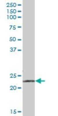 Western Blot: RPE Antibody [H00006120-B02P] - Analysis of RPE expression in human liver.
