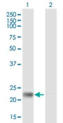 Western Blot: RPE Antibody [H00006120-B02P] - Analysis of RPE expression in transfected 293T cell line by RPE polyclonal antibody.  Lane 1: RPE transfected lysate(25.08 KDa). Lane 2: Non-transfected lysate.