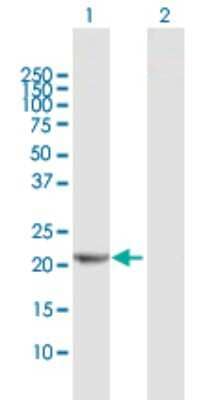Western Blot: RPE Antibody [H00006120-D01P] - Analysis of RPE expression in transfected 293T cell line by RPE polyclonal antibody.Lane 1: RPE transfected lysate(24.90 KDa).Lane 2: Non-transfected lysate.