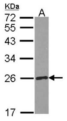 Western Blot: RPE Antibody [NBP2-20208] - Sample (30 ug of whole cell lysate) A: 293T 12% SDS PAGE gel, diluted at 1:1000.