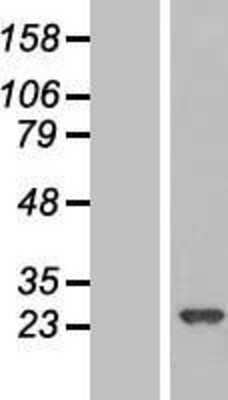 Western Blot: RPE Overexpression Lysate (Adult Normal) [NBL1-15494] Left-Empty vector transfected control cell lysate (HEK293 cell lysate); Right -Over-expression Lysate for RPE.