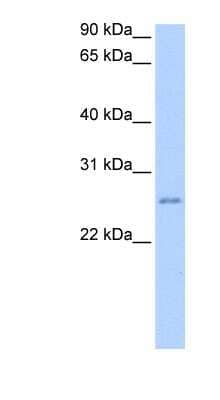 Western Blot: RPESP Antibody [NBP1-70697] - Jurkat cell lysate, concentration 0.2-1 ug/ml.
