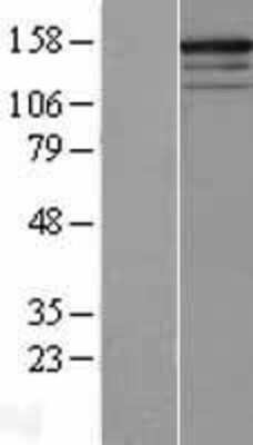 Western Blot: RPGRIP1 Overexpression Lysate (Adult Normal) [NBL1-15496] Left-Empty vector transfected control cell lysate (HEK293 cell lysate); Right -Over-expression Lysate for RPGRIP1.