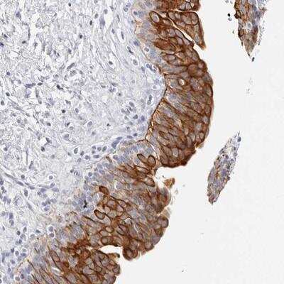 Immunohistochemistry-Paraffin: RPH3AL Antibody [NBP1-80991] - Staining of human urinary bladder shows strong cytoplasmic positivity in urothelial cells.