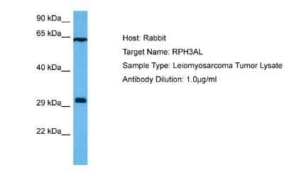 Western Blot: RPH3AL Antibody [NBP2-83466] - Host: Rabbit. Target Name: RPH3AL. Sample Tissue: Human Leiomyosarcoma Tumor lysates. Antibody Dilution: 1ug/ml