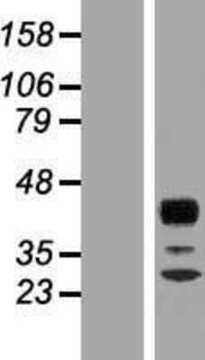 Western Blot: RPH3AL Overexpression Lysate (Adult Normal) [NBP2-07546] Left-Empty vector transfected control cell lysate (HEK293 cell lysate); Right -Over-expression Lysate for RPH3AL.