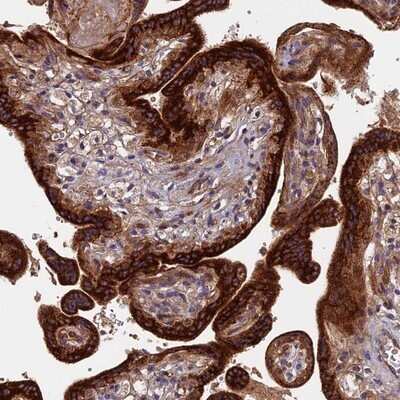 Immunohistochemistry-Paraffin: RPIA Antibody [NBP1-86214] - Staining of human placenta shows strong cytoplasmic positivity in trophoblastic cells.