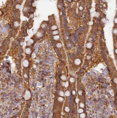 Immunohistochemistry-Paraffin RPIA Antibody