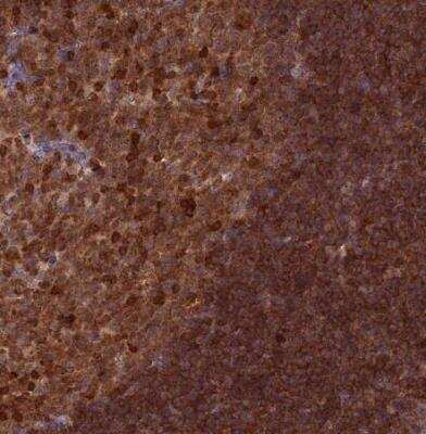 Immunohistochemistry-Paraffin RPIA Antibody