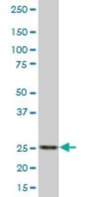 Western Blot: RPIA Antibody [H00022934-B01P] - Analysis of RPIA expression in human spleen.