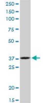 Western Blot: RPIA Antibody [H00022934-B01P] - Analysis of RPIA expression in human ovarian cancer.
