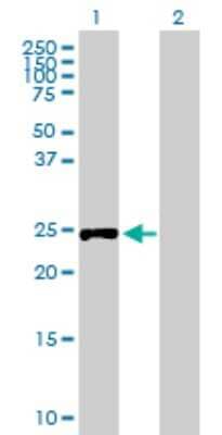 Western Blot: RPIA Antibody [H00022934-B02P] - Analysis of RPIA expression in transfected 293T cell line by RPIA polyclonal antibody.  Lane 1: RPIA transfected lysate(26.07 KDa). Lane 2: Non-transfected lysate.