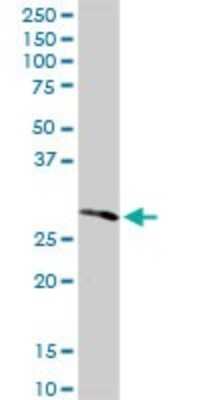 Western Blot: RPIA Antibody [H00022934-D01P] - Analysis of RPIA expression in human kidney.
