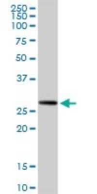 Western Blot: RPIA Antibody [H00022934-D01P] - Analysis of RPIA expression in mouse kidney.