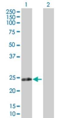 Western Blot: RPIA Antibody [H00022934-D01P] - Analysis of RPIA expression in transfected 293T cell line by RPIA polyclonal antibody.Lane 1: RPIA transfected lysate(26.10 KDa).Lane 2: Non-transfected lysate.