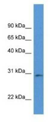 Western Blot: RPIA Antibody [NBP1-79588] - Mouse Pancreas Lysate 1ug/ml  Gel Concentration 12%