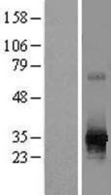 Western Blot: RPIA Overexpression Lysate (Adult Normal) [NBL1-15498] Left-Empty vector transfected control cell lysate (HEK293 cell lysate); Right -Over-expression Lysate for RPIA.