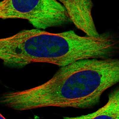 Immunocytochemistry/Immunofluorescence: RPL10A Antibody [NBP2-47298] - Staining of human cell line U-2 OS shows localization to nucleoli, cytosol & endoplasmic reticulum. Antibody staining is shown in green.