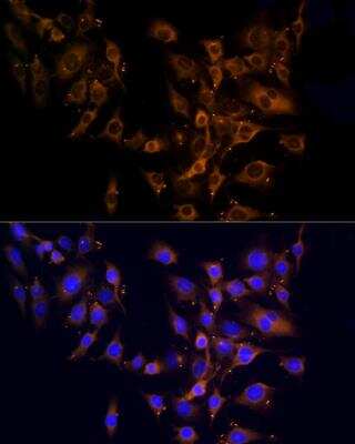 Immunocytochemistry/ Immunofluorescence RPL10A Antibody - BSA Free