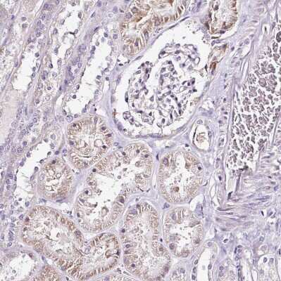 Immunohistochemistry-Paraffin: RPL10A Antibody [NBP2-47298] - Staining of human kidney shows weak cytoplasmic positivity in cells in tubules.