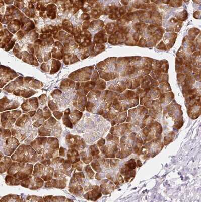Immunohistochemistry-Paraffin: RPL10A Antibody [NBP2-47298] - Staining of human pancreas shows strong cytoplasmic positivity in exocrine glandular cells.
