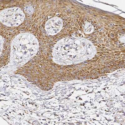 Immunohistochemistry-Paraffin: RPL10A Antibody [NBP2-47298] - Staining of human skin shows  strong cytoplasmic positivity in squamous epithelial cells.