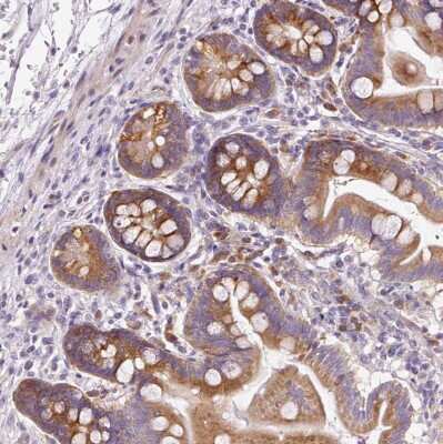 Immunohistochemistry-Paraffin: RPL10A Antibody [NBP2-47298] - Staining of human small intestine shows moderate cytoplasmic positivity in glandular cells.