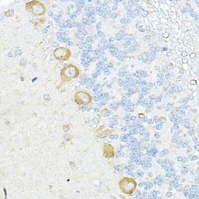 Immunohistochemistry-Paraffin RPL10A Antibody - BSA Free