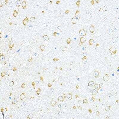 Immunohistochemistry-Paraffin RPL10A Antibody - BSA Free