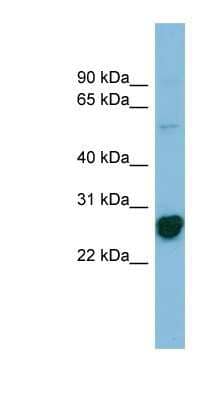 Western Blot: RPL10A Antibody [NBP1-56386] - Jurkat cell lysate, concentration 0.2-1 ug/ml.