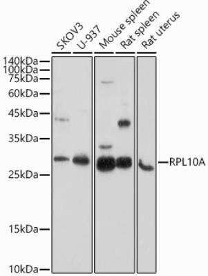 Western Blot RPL10A Antibody - BSA Free