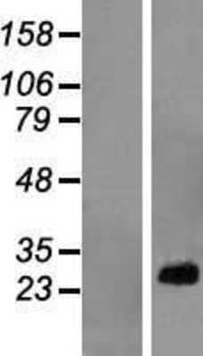 Western Blot RPL10A Overexpression Lysate