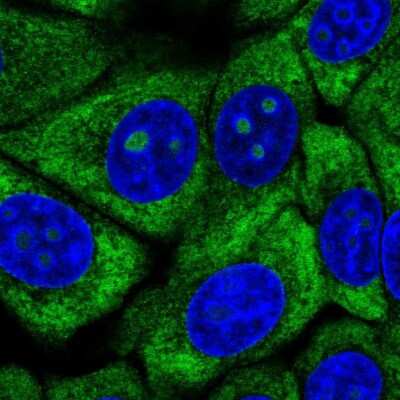 <b>Genetic Strategies Validation. </b>Immunocytochemistry/Immunofluorescence: RPL13 Antibody [NBP2-13250] - Staining of human cell line MCF7 shows localization to nucleoli, cytosol & endoplasmic reticulum. Antibody staining is shown in green.