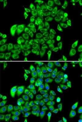 Immunocytochemistry/Immunofluorescence: RPL13 Antibody [NBP2-94110] - Analysis of MCF-7 cells using RPL13 . Blue: DAPI for nuclear staining.