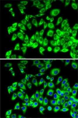 Immunocytochemistry/Immunofluorescence: RPL13 Antibody [NBP2-94875] - Analysis of MCF7 cells using RPL13 . Blue: DAPI for nuclear staining.