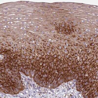 Immunohistochemistry-Paraffin: RPL13 Antibody [NBP2-13250] - Staining of human esophagus shows strong cytoplasmic positivity in squamous epithelial cells.