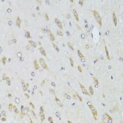 Immunohistochemistry-Paraffin: RPL13 Antibody [NBP2-94110] - Paraffin-embedded mouse brain using RPL13 .