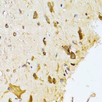 Immunohistochemistry-Paraffin: RPL13 Antibody [NBP2-94110] - Paraffin-embedded rat spinal cord using RPL13 .